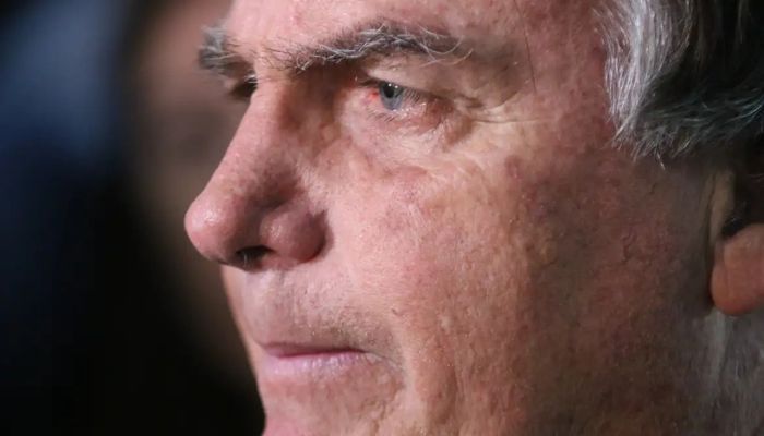 © Tânia Rêgo/Agência Brasil Com crise persistente de soluços, Bolsonaro faz nova cirurgia